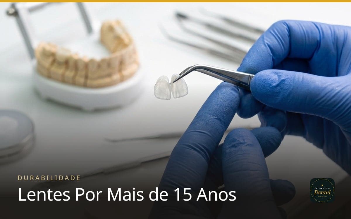 Como Fazer as Lentes de Contato Dental Durarem Mais de 15 Anos?