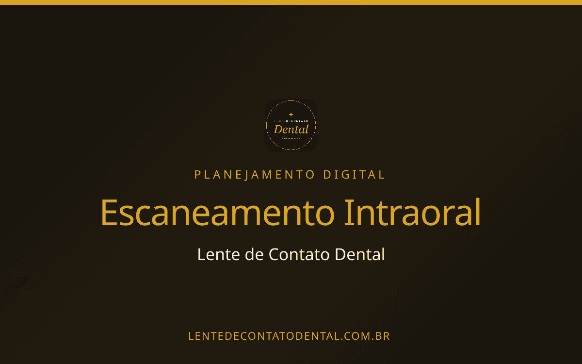 Escaneamento intraoral para facetas: o que muda de verdade