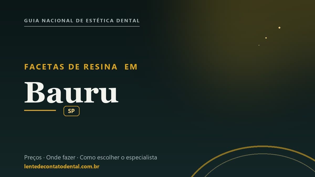 Imagem ilustrativa do artigo sobre Facetas de Resina
