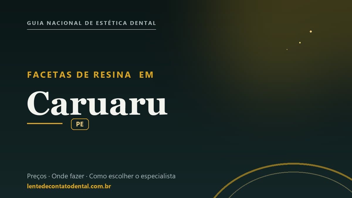 Imagem ilustrativa do artigo sobre Facetas de Resina