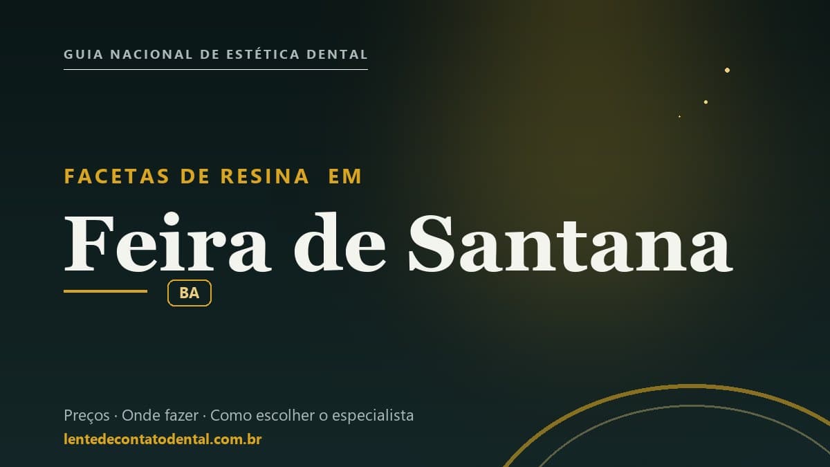 Imagem ilustrativa do artigo sobre Facetas de Resina
