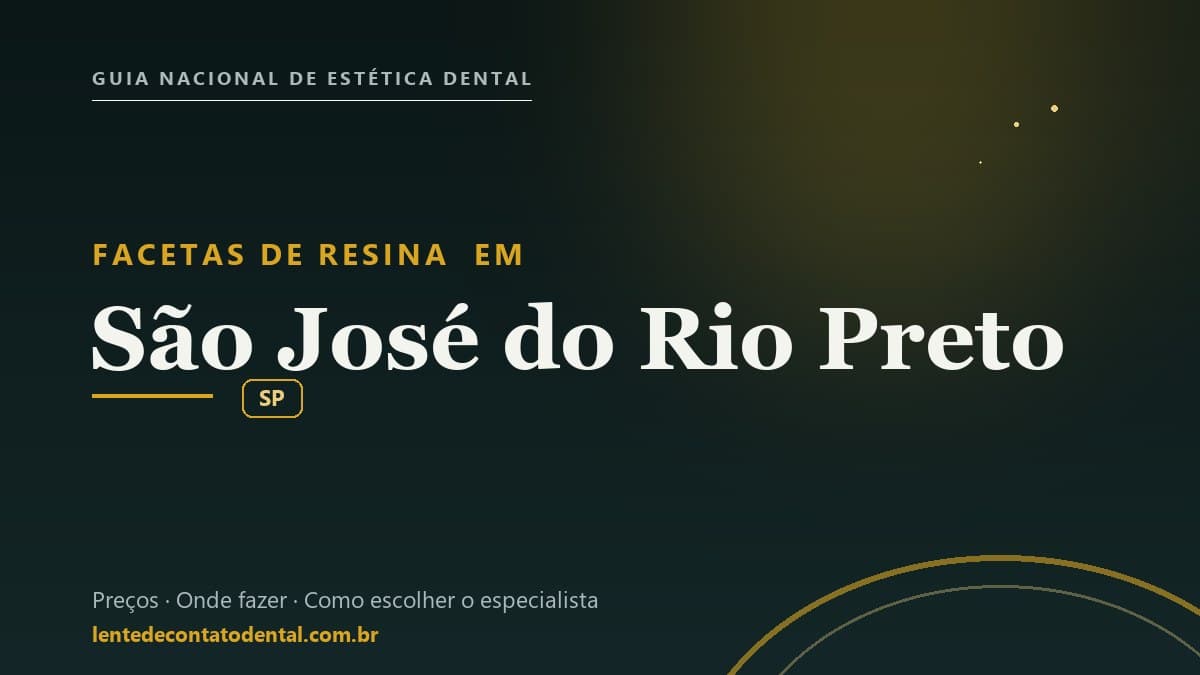 Imagem ilustrativa do artigo sobre Facetas de Resina