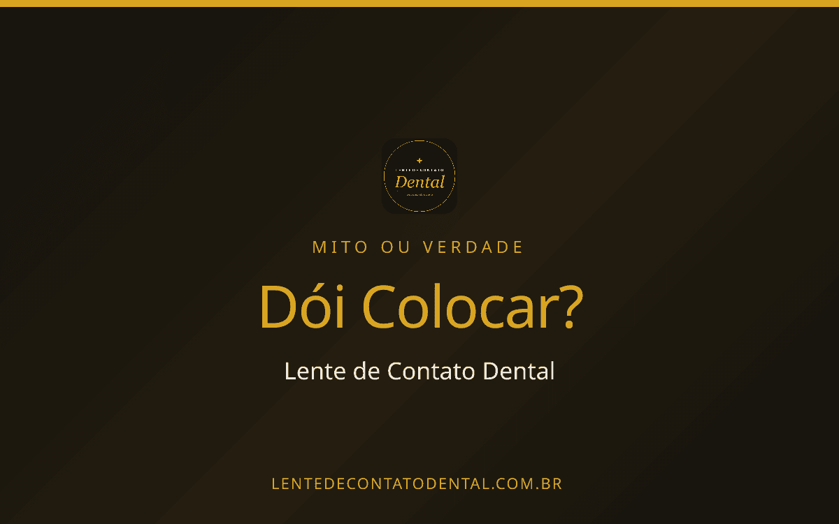 Imagem ilustrativa do artigo sobre Lente de Contato Dental