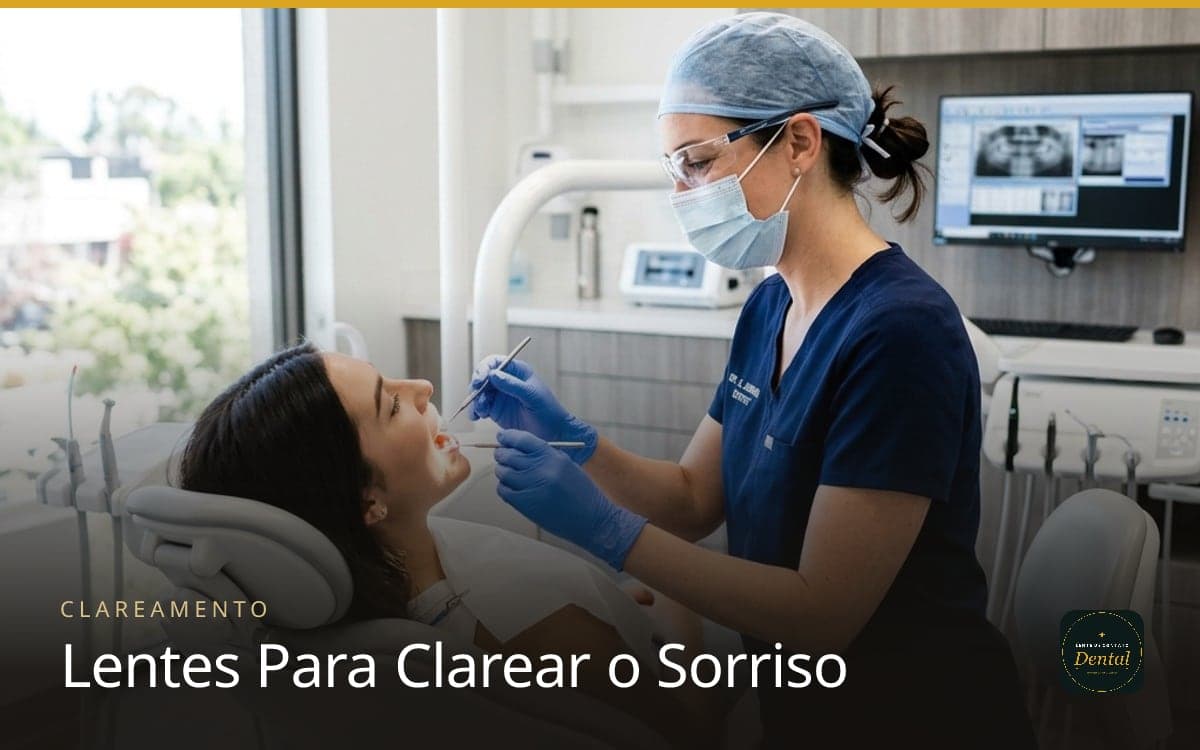 Lentes de Contato Dental para Clareamento: Qual a Melhor Opção em 2026?
