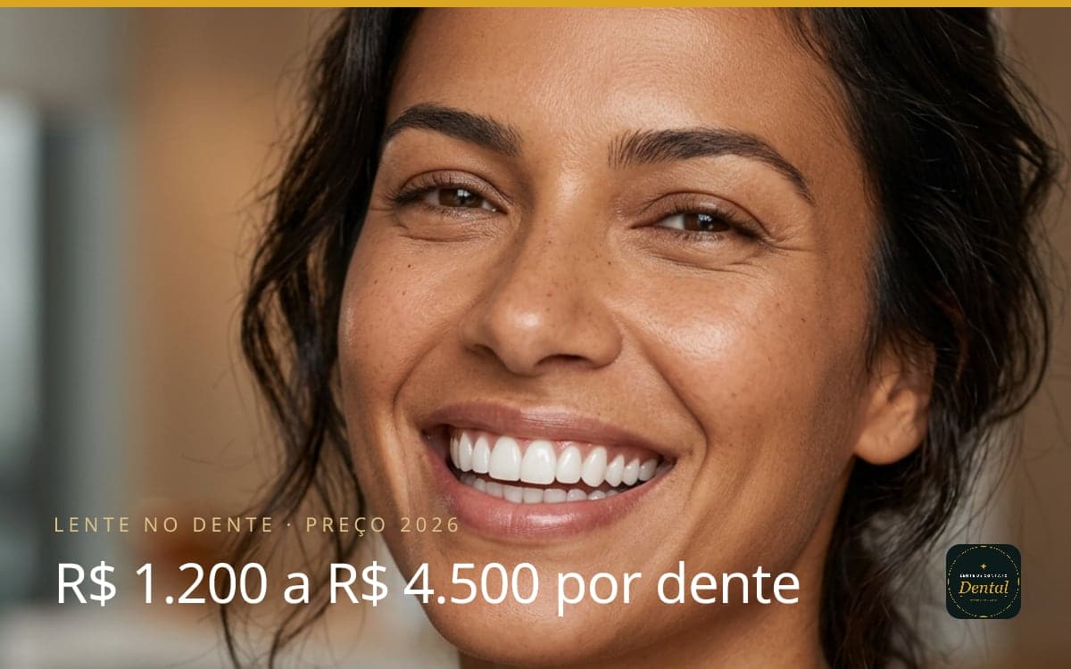 Quanto Custa Lente no Dente? Preço da Lente de Contato Dental em 2026: R$ 1.200 a R$ 4.500 por Dente