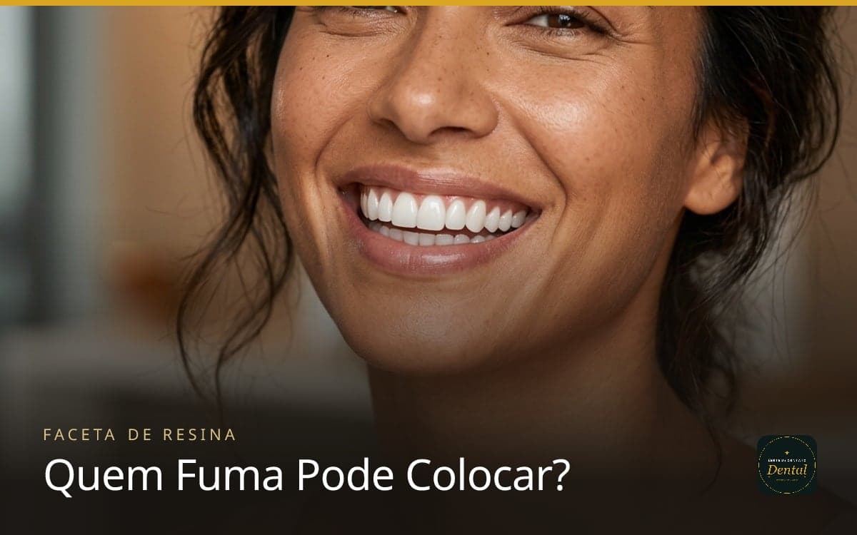 Quem Fuma Pode Colocar Faceta de Resina? Pode, Mas Dura Bem Menos