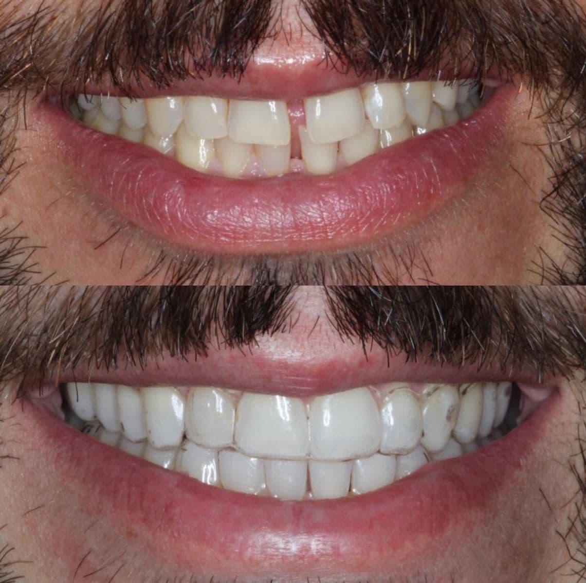 Dr(a). Dra. Juliana Pelegrini - Especialista em Lentes de Contato Dental em Campinas