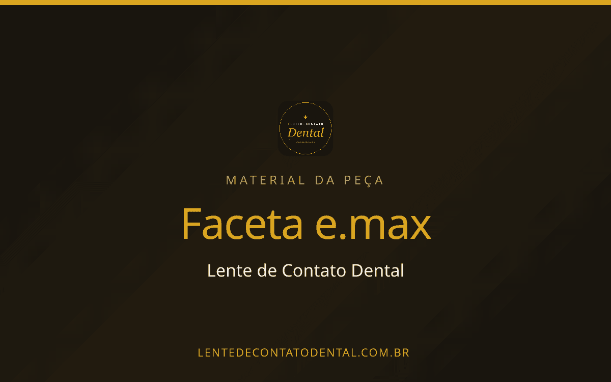 Faceta e.max: o que é, resistência publicada e quando compensa