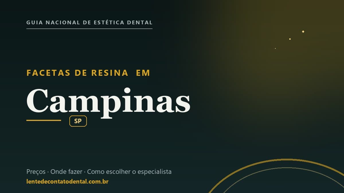Imagem ilustrativa do artigo sobre Facetas de Resina