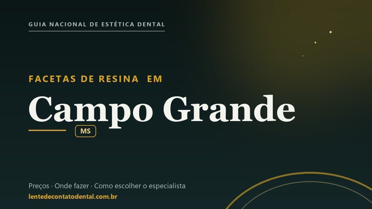 Imagem ilustrativa do artigo sobre Facetas de Resina