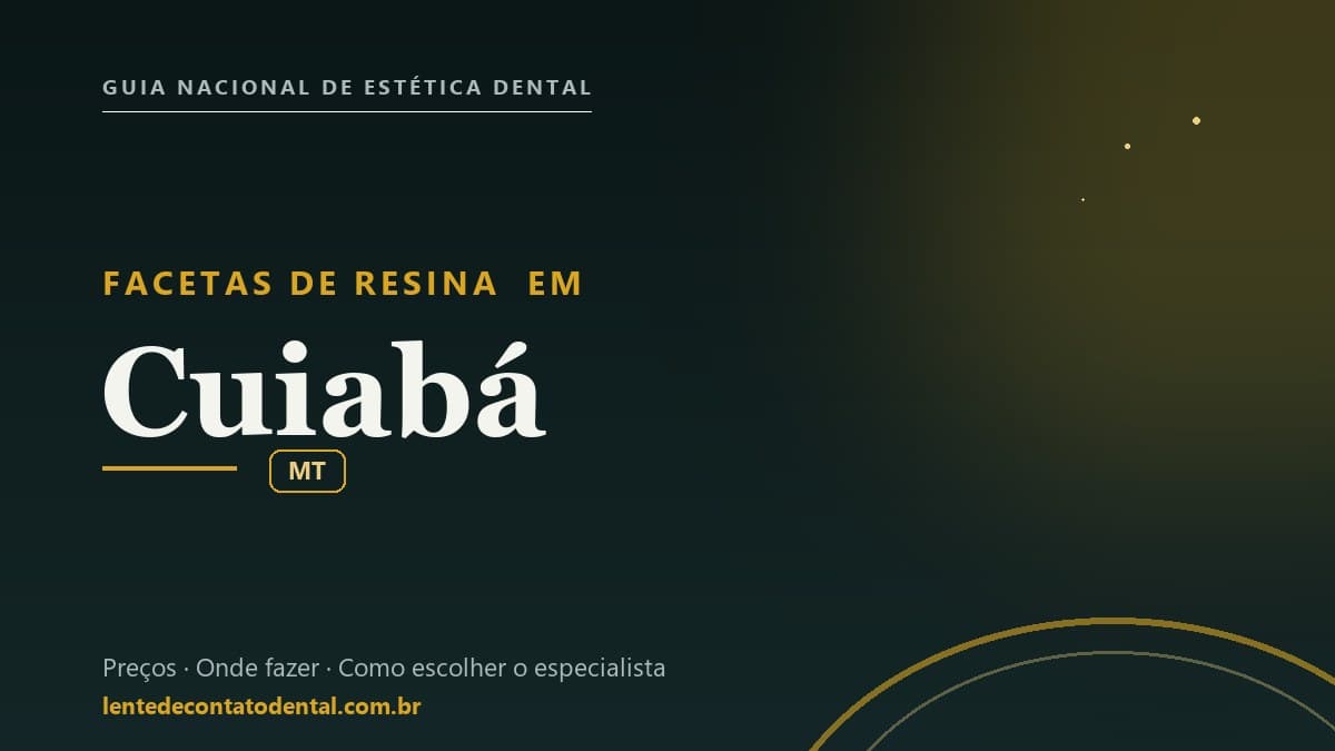 Imagem ilustrativa do artigo sobre Facetas de Resina