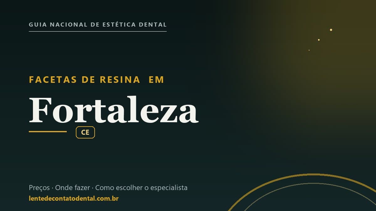Imagem ilustrativa do artigo sobre Facetas de Resina