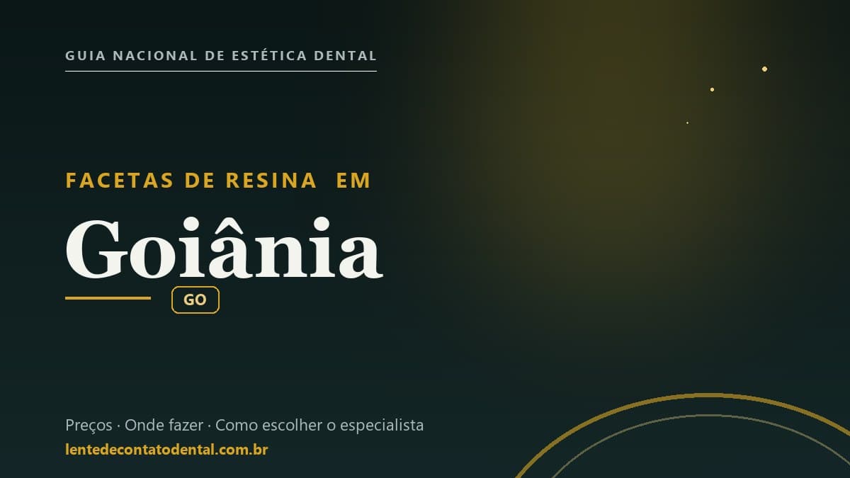Imagem ilustrativa do artigo sobre Facetas de Resina
