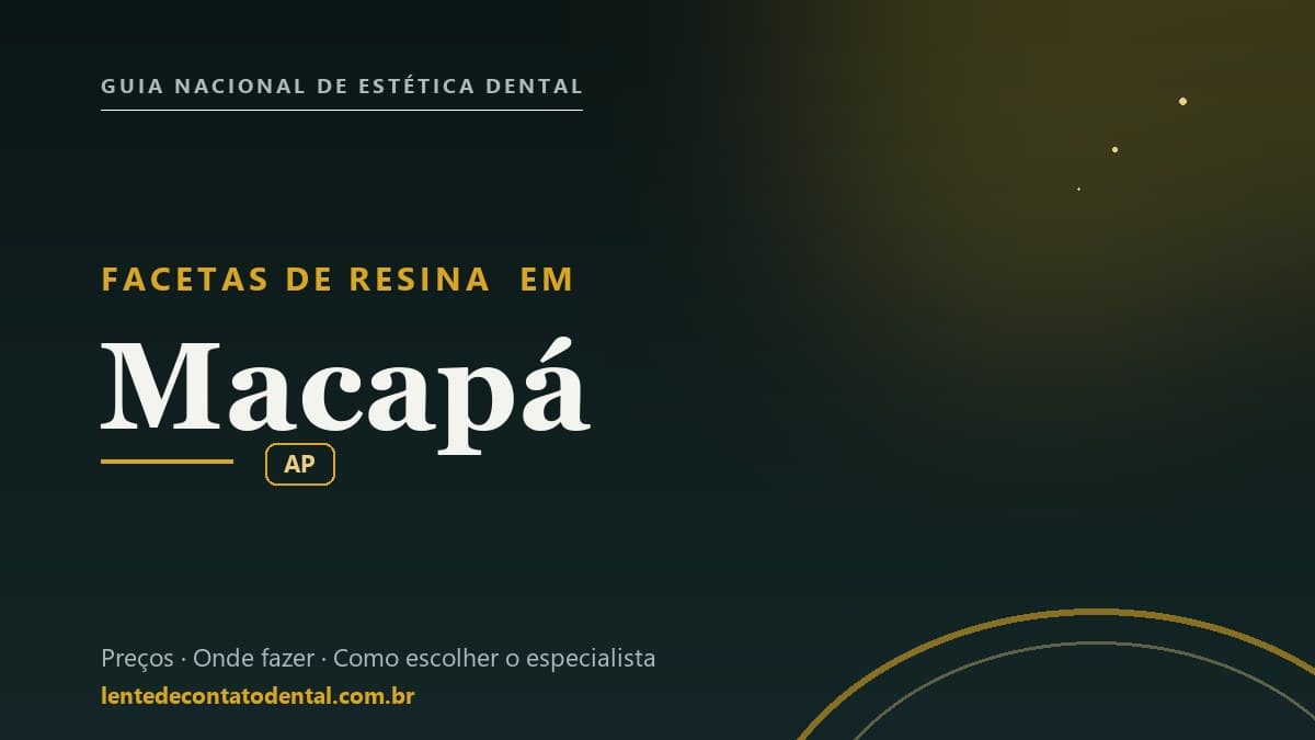 Imagem ilustrativa do artigo sobre Facetas de Resina