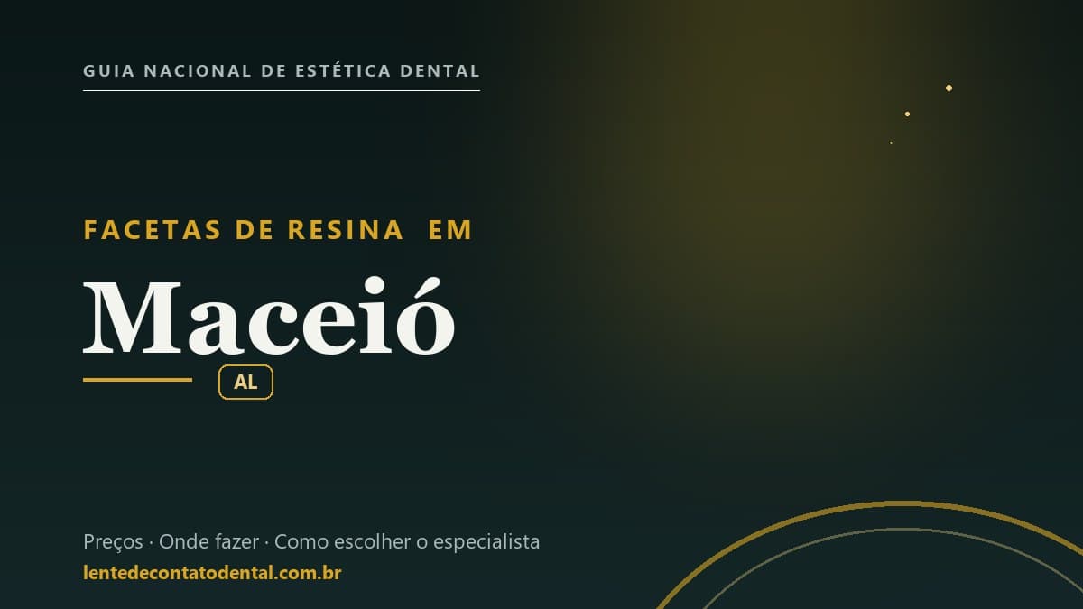 Imagem ilustrativa do artigo sobre Facetas de Resina