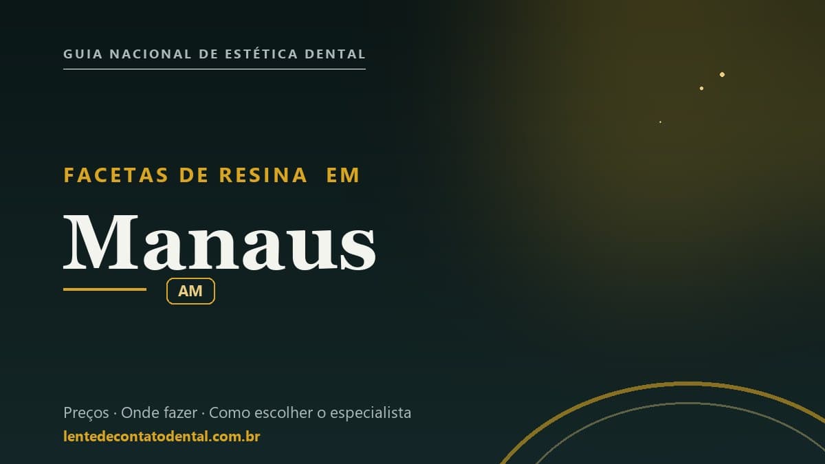 Imagem ilustrativa do artigo sobre Facetas de Resina