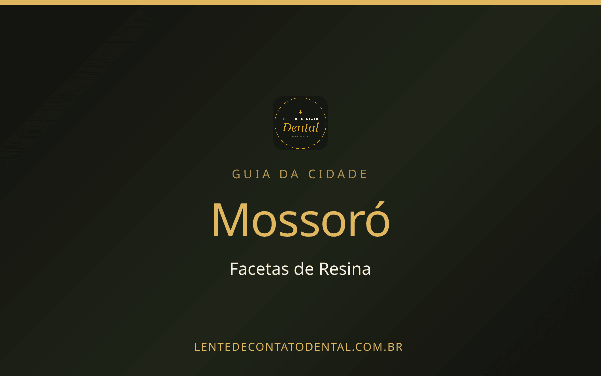 Imagem ilustrativa do artigo sobre Facetas de Resina