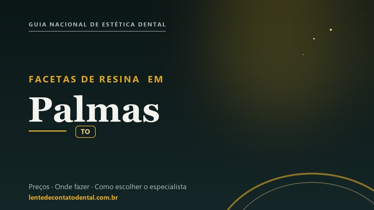 Imagem ilustrativa do artigo sobre Facetas de Resina