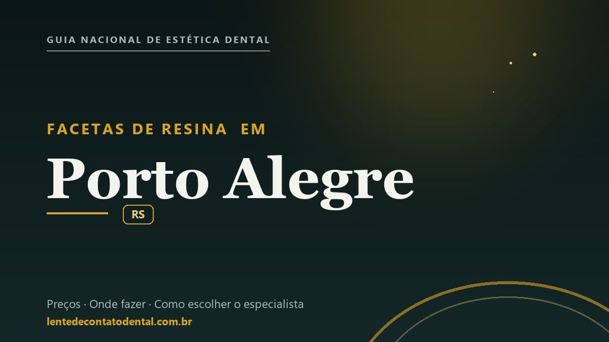 Imagem ilustrativa do artigo sobre Facetas de Resina