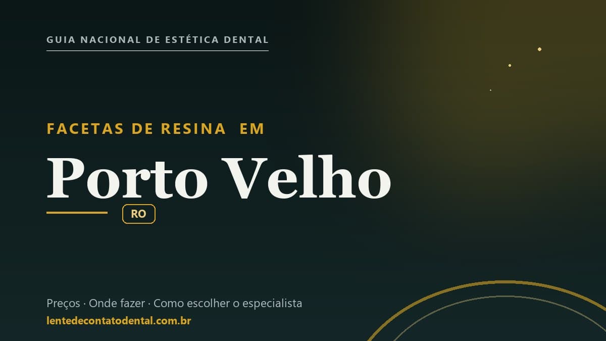 Imagem ilustrativa do artigo sobre Facetas de Resina