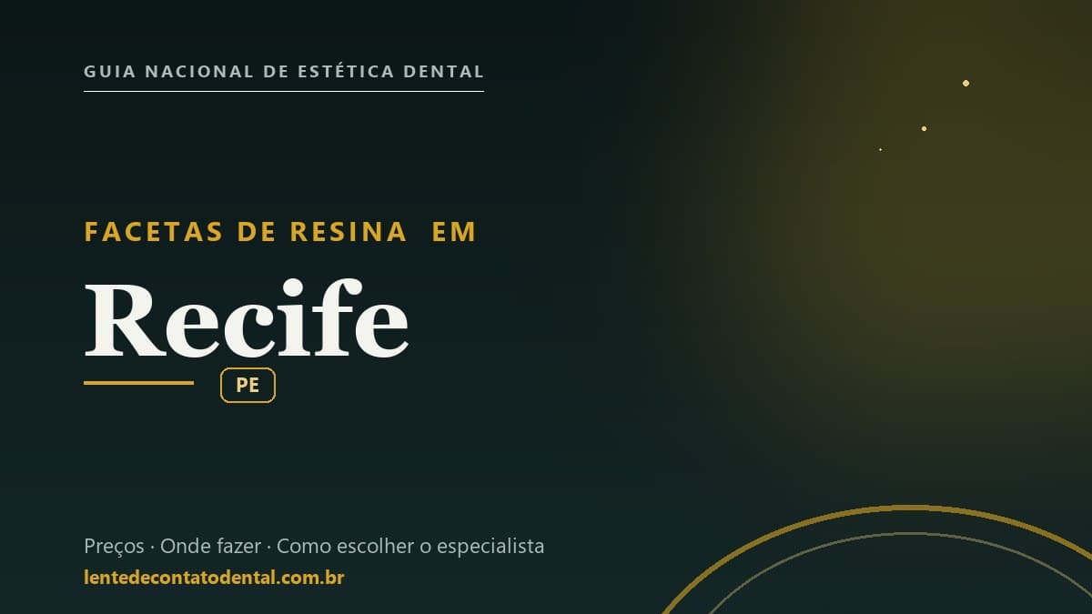 Imagem ilustrativa do artigo sobre Facetas de Resina