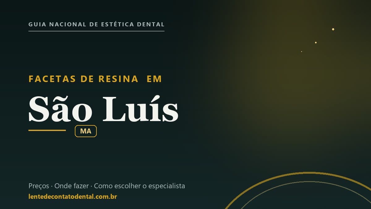Imagem ilustrativa do artigo sobre Facetas de Resina
