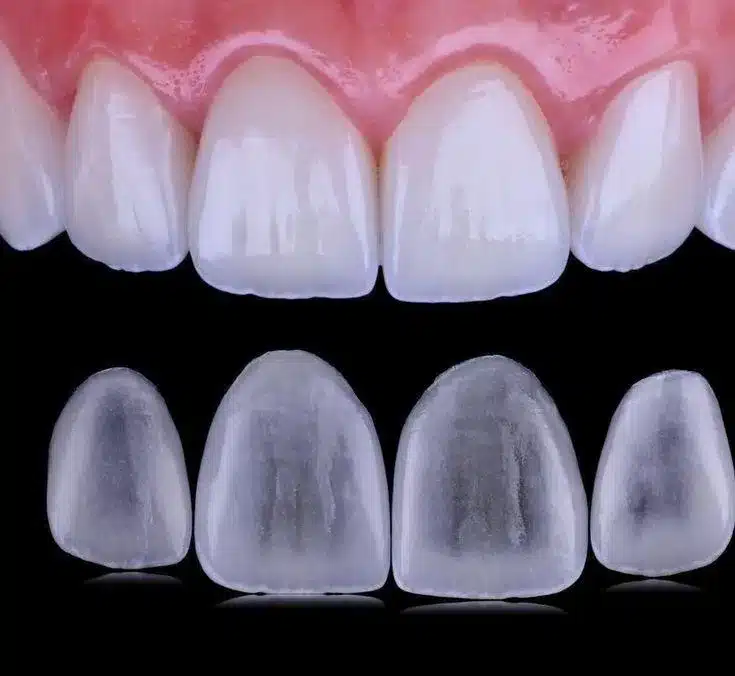Imagem ilustrativa do artigo sobre Porcelana